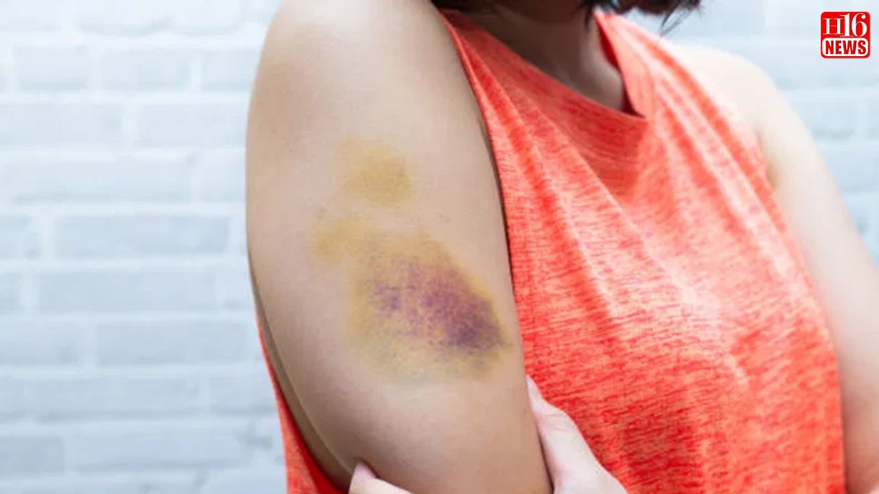 Surgeon explains the impact of circulatory health on cellulitis
